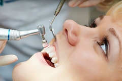 Зачем нужна профессиональная чистка зубов у стоматолога?